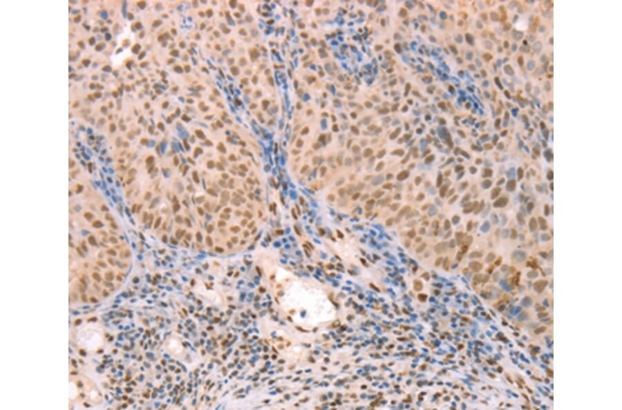 Immunohistochemistry - PTMA Antibody from Signalway Antibody (37277) - Antibodies.com