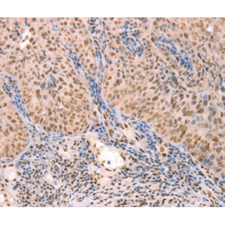 Immunohistochemistry - PTMA Antibody from Signalway Antibody (37277) - Antibodies.com