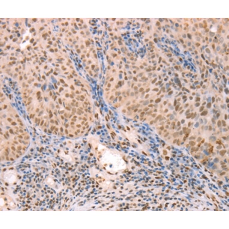 Immunohistochemistry - PTMA Antibody from Signalway Antibody (37277) - Antibodies.com