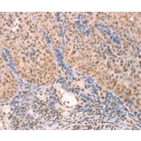 Immunohistochemistry - PTMA Antibody from Signalway Antibody (37277) - Antibodies.com