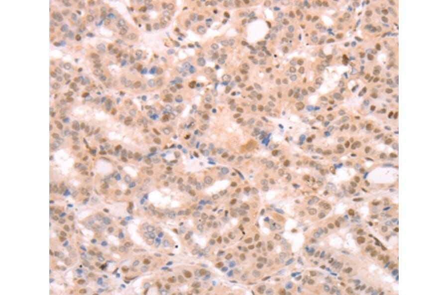 Immunohistochemistry - PTMA Antibody from Signalway Antibody (37277) - Antibodies.com