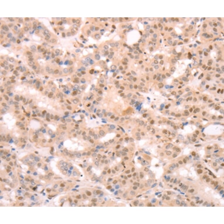 Immunohistochemistry - PTMA Antibody from Signalway Antibody (37277) - Antibodies.com