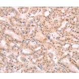 Immunohistochemistry - PTMA Antibody from Signalway Antibody (37277) - Antibodies.com