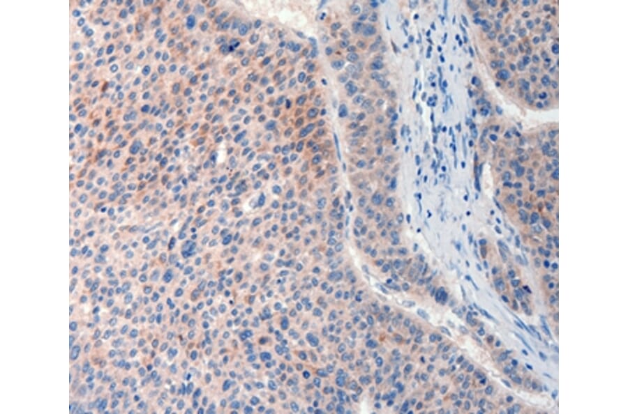 Immunohistochemistry - FAT4 Antibody from Signalway Antibody (37293) - Antibodies.com