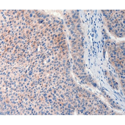 Immunohistochemistry - FAT4 Antibody from Signalway Antibody (37293) - Antibodies.com