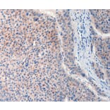 Immunohistochemistry - FAT4 Antibody from Signalway Antibody (37293) - Antibodies.com