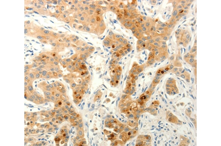 Immunohistochemistry - FAT4 Antibody from Signalway Antibody (37293) - Antibodies.com