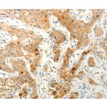 Immunohistochemistry - FAT4 Antibody from Signalway Antibody (37293) - Antibodies.com