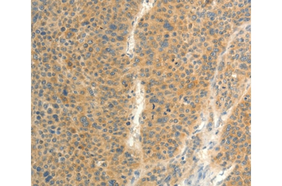 Immunohistochemistry - FAT3 Antibody from Signalway Antibody (37294) - Antibodies.com