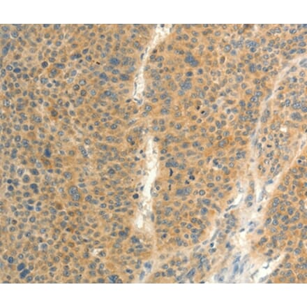 Immunohistochemistry - FAT3 Antibody from Signalway Antibody (37294) - Antibodies.com