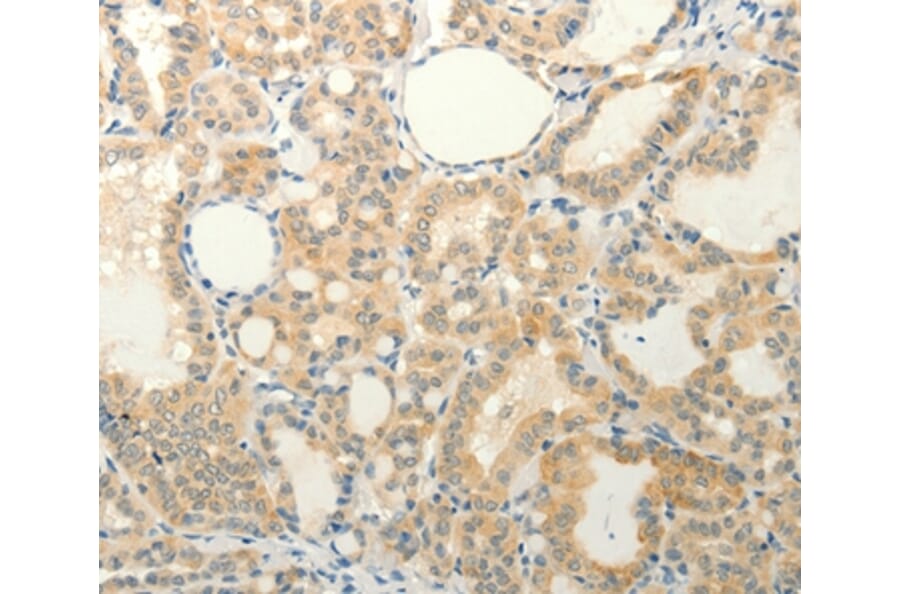Immunohistochemistry - FAT3 Antibody from Signalway Antibody (37294) - Antibodies.com