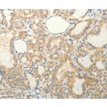 Immunohistochemistry - FAT3 Antibody from Signalway Antibody (37294) - Antibodies.com