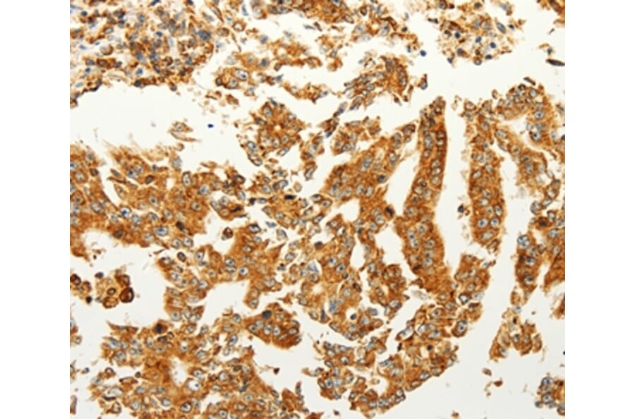 Immunohistochemistry - FZD6 Antibody from Signalway Antibody (37296) - Antibodies.com