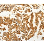 Immunohistochemistry - FZD6 Antibody from Signalway Antibody (37296) - Antibodies.com