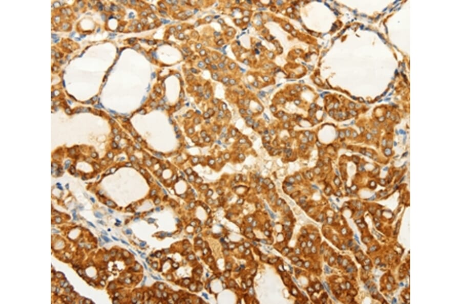 Immunohistochemistry - FZD6 Antibody from Signalway Antibody (37296) - Antibodies.com