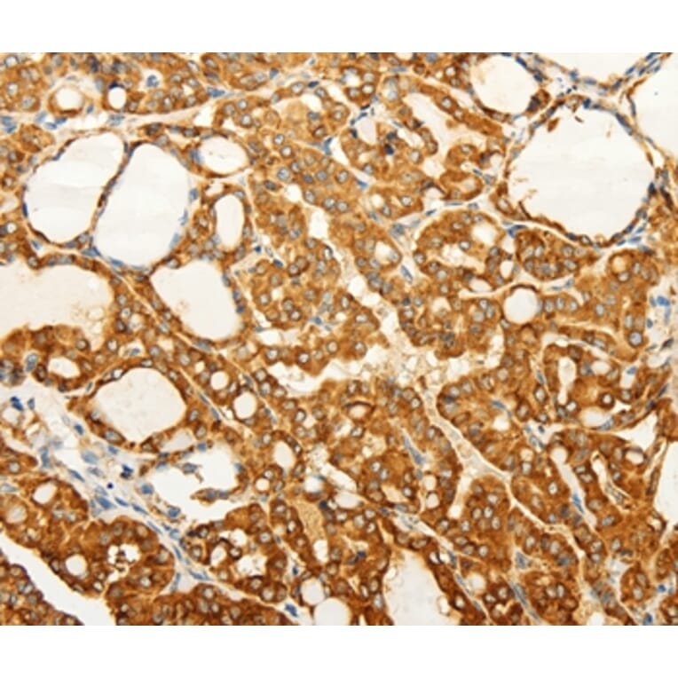 Immunohistochemistry - FZD6 Antibody from Signalway Antibody (37296) - Antibodies.com