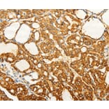 Immunohistochemistry - FZD6 Antibody from Signalway Antibody (37296) - Antibodies.com