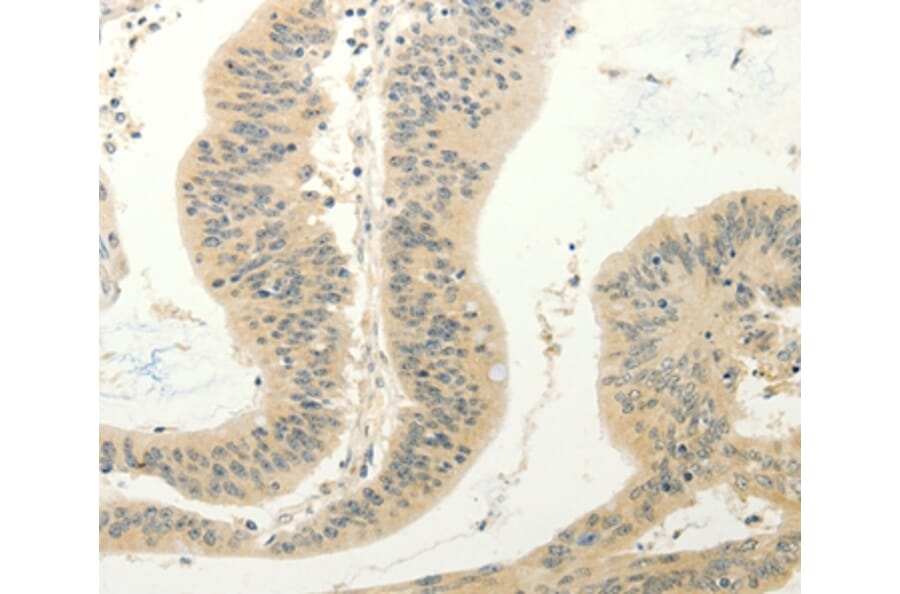 Immunohistochemistry - FZD8 Antibody from Signalway Antibody (37297) - Antibodies.com