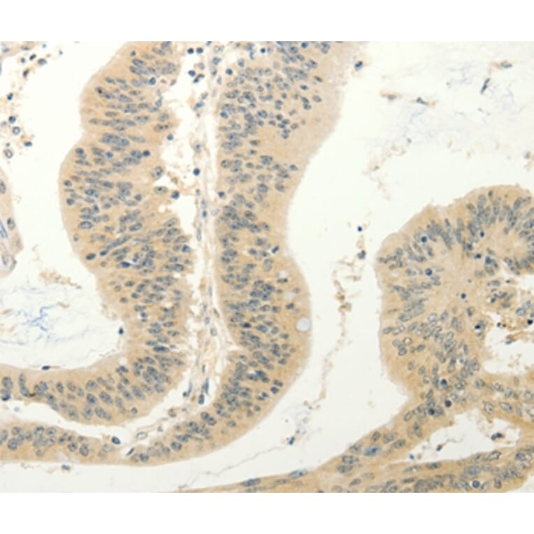 Immunohistochemistry - FZD8 Antibody from Signalway Antibody (37297) - Antibodies.com