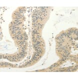 Immunohistochemistry - FZD8 Antibody from Signalway Antibody (37297) - Antibodies.com