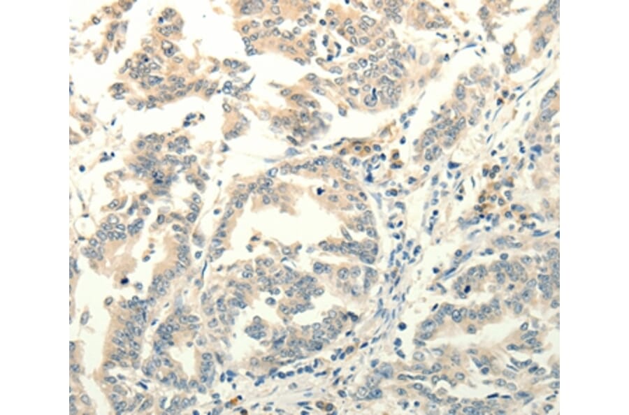 Immunohistochemistry - FZD8 Antibody from Signalway Antibody (37297) - Antibodies.com