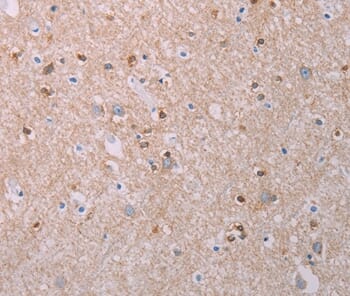 Immunohistochemical analysis of paraffin-embedded Human brain tissue using #37320 at dilution 1/70.