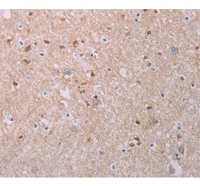 Immunohistochemistry - AKT2 Antibody from Signalway Antibody (37320) - Antibodies.com