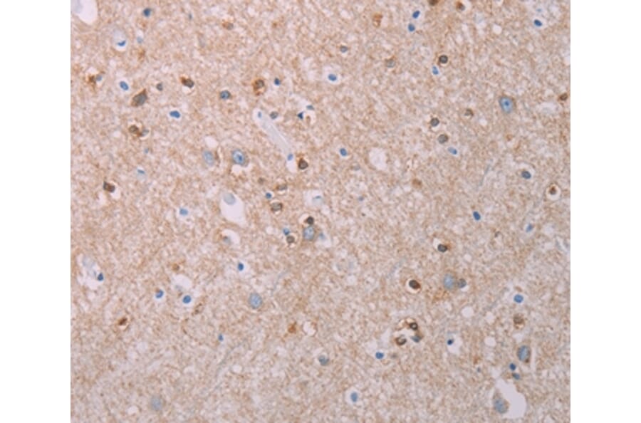 Immunohistochemistry - AKT2 Antibody from Signalway Antibody (37320) - Antibodies.com