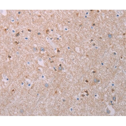Immunohistochemistry - AKT2 Antibody from Signalway Antibody (37320) - Antibodies.com