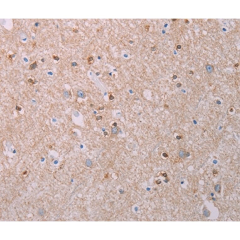 Immunohistochemistry - AKT2 Antibody from Signalway Antibody (37320) - Antibodies.com
