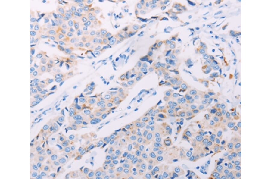 Immunohistochemistry - AKT2 Antibody from Signalway Antibody (37320) - Antibodies.com