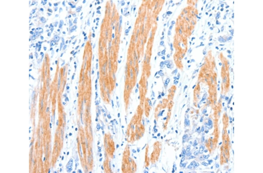 Immunohistochemistry - AKT3 Antibody from Signalway Antibody (37321) - Antibodies.com