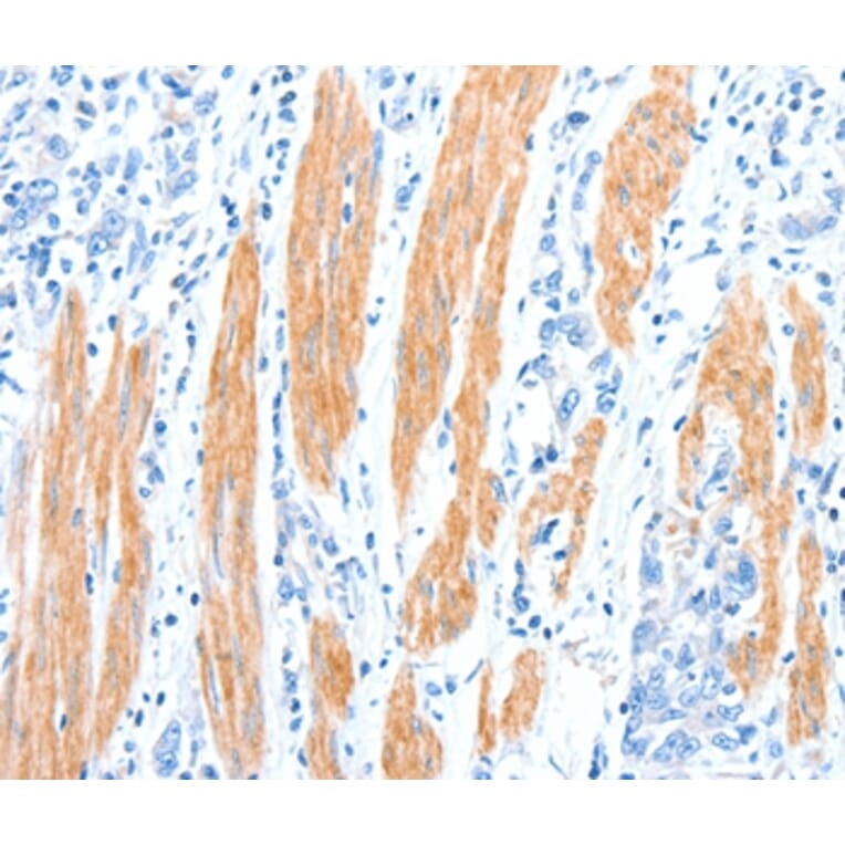 Immunohistochemistry - AKT3 Antibody from Signalway Antibody (37321) - Antibodies.com