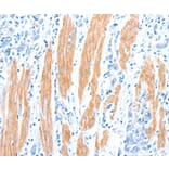 Immunohistochemistry - AKT3 Antibody from Signalway Antibody (37321) - Antibodies.com