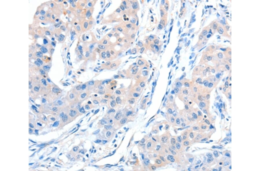 Immunohistochemistry - AKT3 Antibody from Signalway Antibody (37321) - Antibodies.com