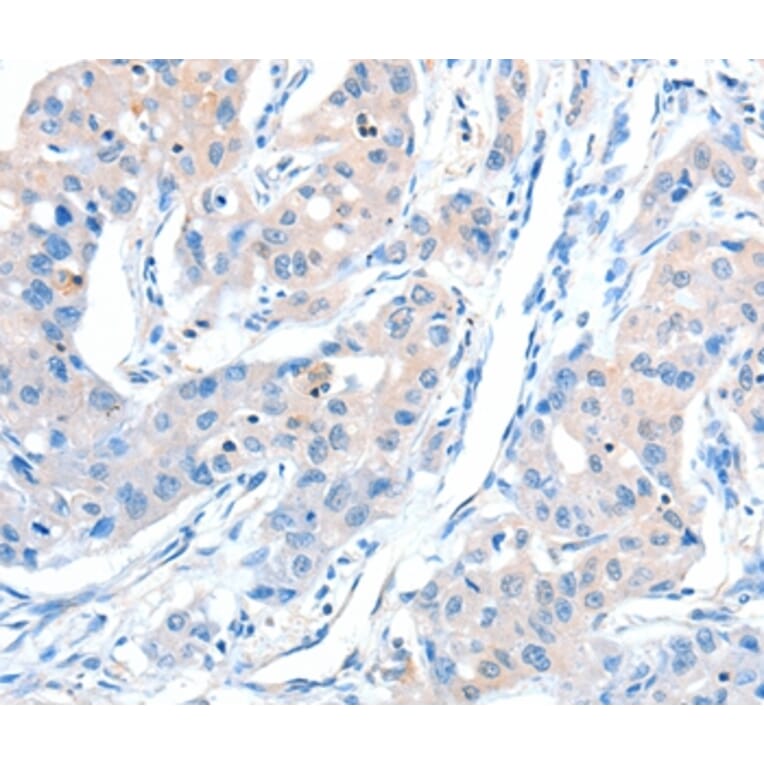 Immunohistochemistry - AKT3 Antibody from Signalway Antibody (37321) - Antibodies.com