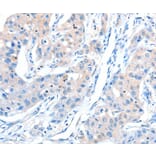Immunohistochemistry - AKT3 Antibody from Signalway Antibody (37321) - Antibodies.com