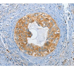 Immunohistochemistry - DGKZ Antibody from Signalway Antibody (37376) - Antibodies.com