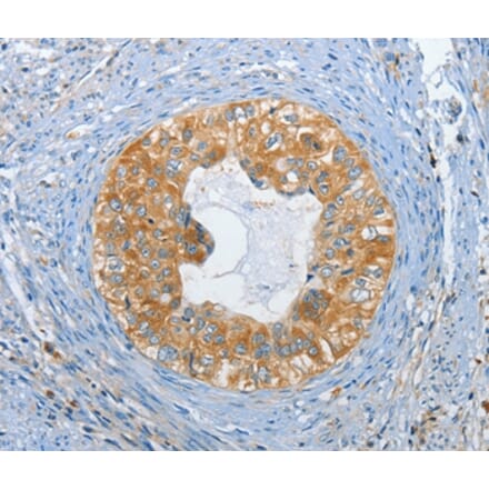 Immunohistochemistry - DGKZ Antibody from Signalway Antibody (37376) - Antibodies.com