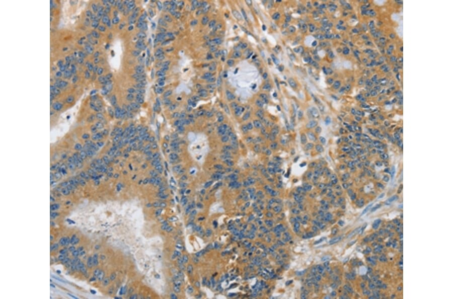 Immunohistochemistry - DGKZ Antibody from Signalway Antibody (37376) - Antibodies.com