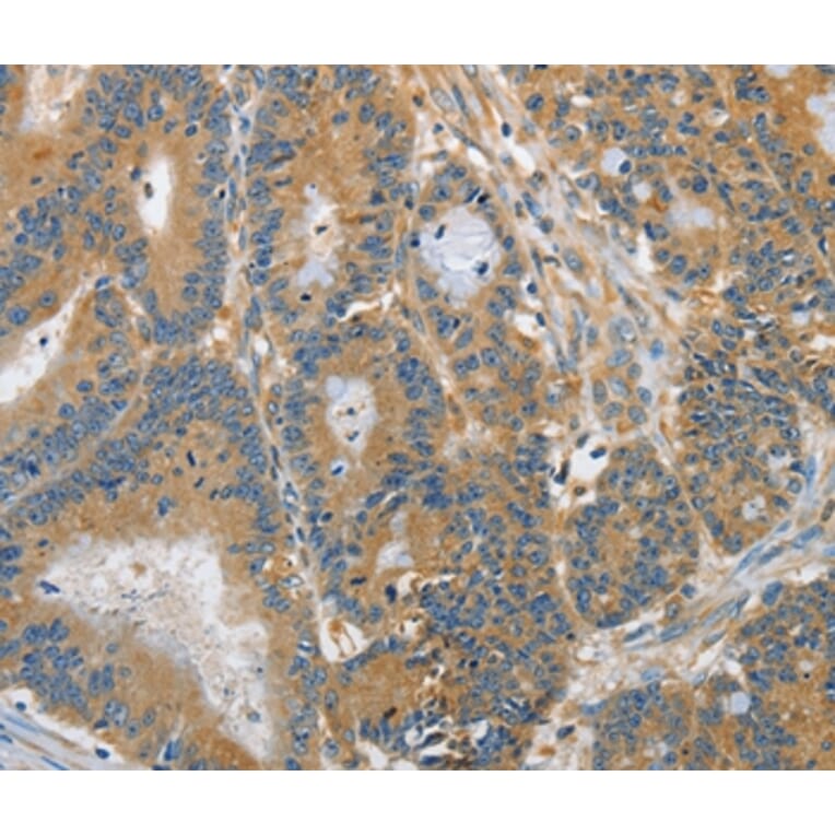 Immunohistochemistry - DGKZ Antibody from Signalway Antibody (37376) - Antibodies.com