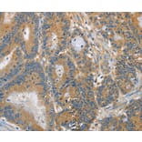 Immunohistochemistry - DGKZ Antibody from Signalway Antibody (37376) - Antibodies.com