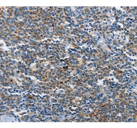 Immunohistochemistry - NEK1 Antibody from Signalway Antibody (37377) - Antibodies.com