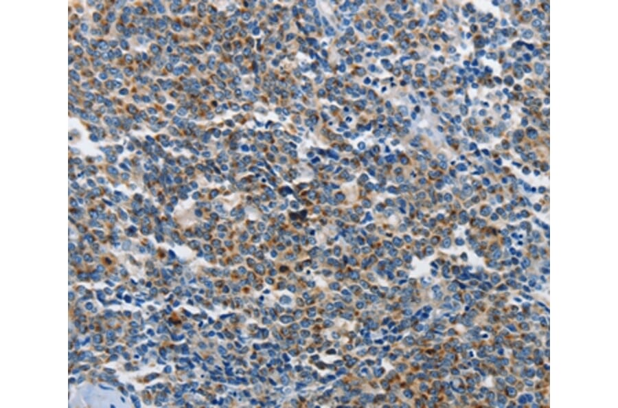 Immunohistochemistry - NEK1 Antibody from Signalway Antibody (37377) - Antibodies.com