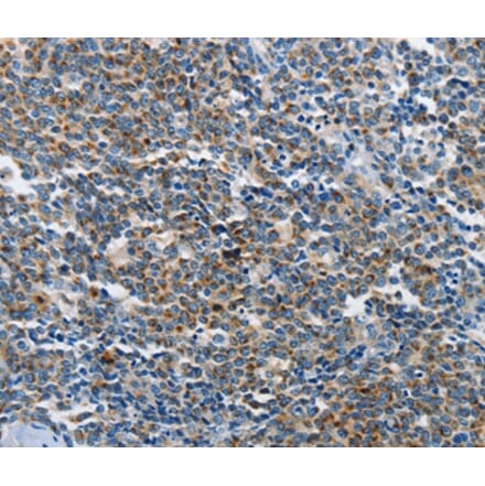 Immunohistochemistry - NEK1 Antibody from Signalway Antibody (37377) - Antibodies.com