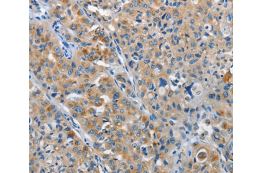 Immunohistochemistry - NEK1 Antibody from Signalway Antibody (37377) - Antibodies.com
