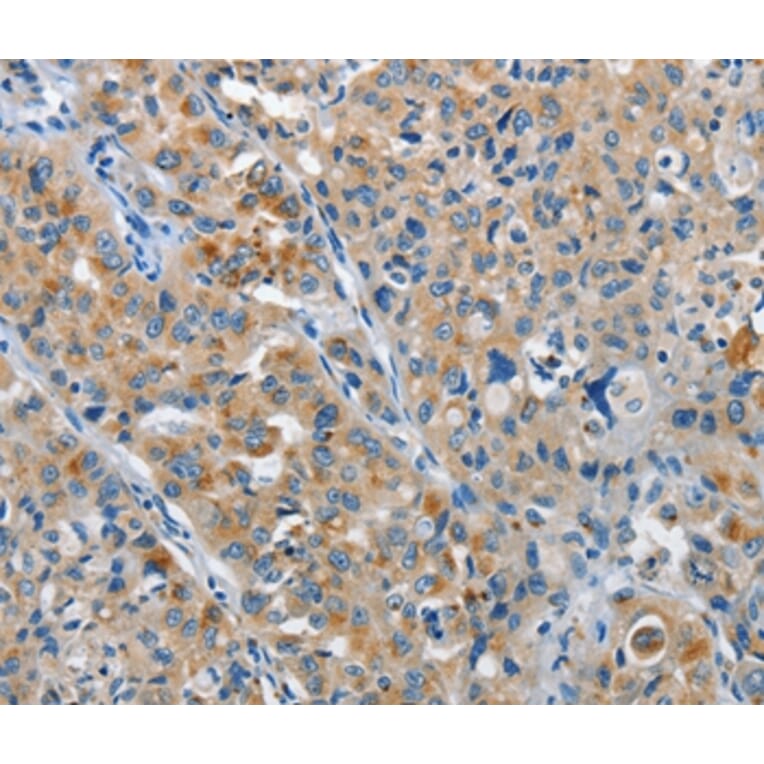 Immunohistochemistry - NEK1 Antibody from Signalway Antibody (37377) - Antibodies.com