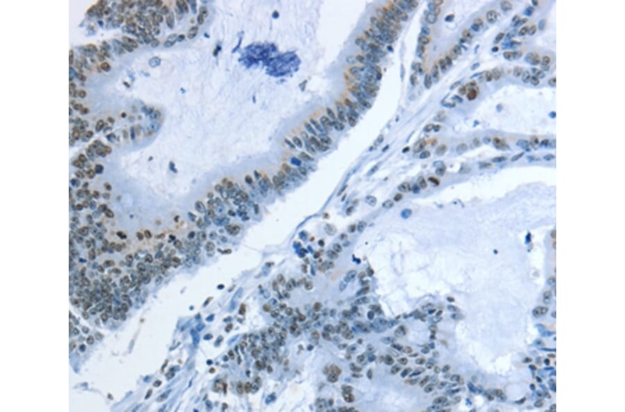 Immunohistochemistry - NEK4 Antibody from Signalway Antibody (37378) - Antibodies.com