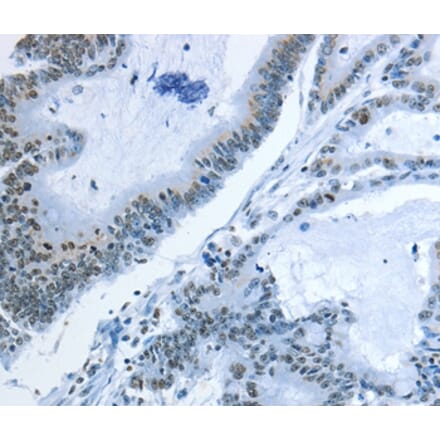Immunohistochemistry - NEK4 Antibody from Signalway Antibody (37378) - Antibodies.com