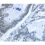 Immunohistochemistry - NEK4 Antibody from Signalway Antibody (37378) - Antibodies.com